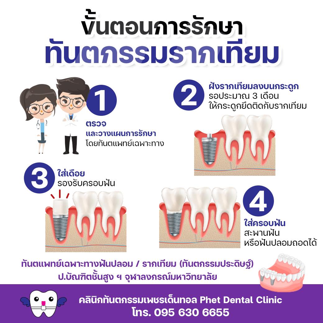 คลินิกทันตกรรมเพชรเด็นทอล - ให้บริการทำฟันครบวงจรโดยทันตแพทย์เฉพาะทาง จัดฟัน-รากเทียม-เอกซเรย์-ฟันปลอม-รักษารากฟัน-ผ่าฟันคุด-ฟอกสีฟัน  รับประกันสังคม  [..]